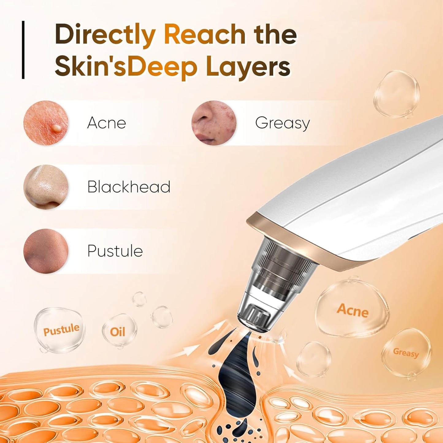 Electric Face Vacuum Blackhead Remover