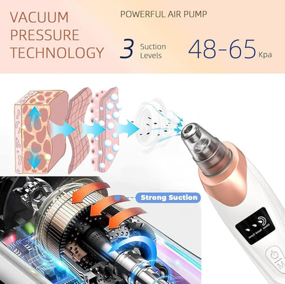 Electric Face Vacuum Blackhead Remover